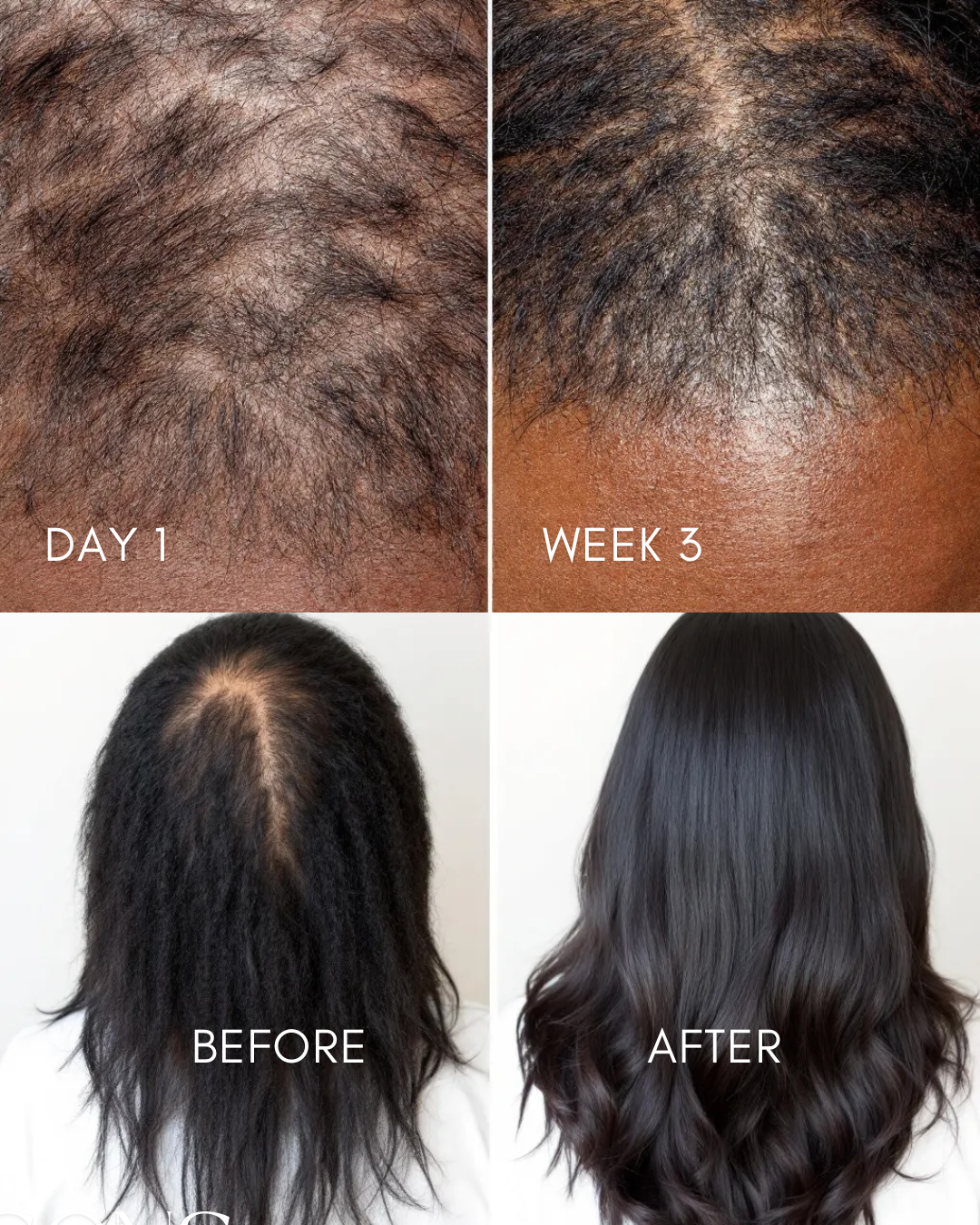 Organic Hair Growth Stimulating Oil